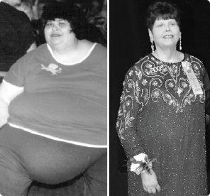 Jo Cooper Before and After Losing 300 Pounds